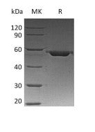 Recombinant Human VDB (C-6His)