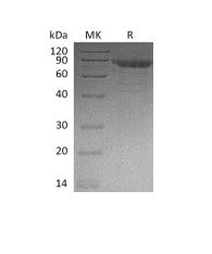 Recombinant Human CDH11 (C-6His)