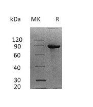 Recombinant Human SDC1 (C-Fc)