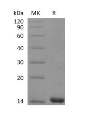 Recombinant Human FGF-4 (136AA)