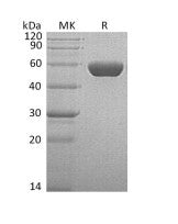 Recombinant Human Serpin A1 (C-6His)
