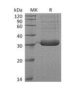 Recombinant Human Collectin-11 (C-6His)