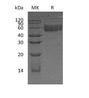 Recombinant Human CD83 (C-Fc)