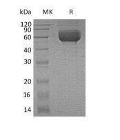 Recombinant Human ST2 (C-6His)