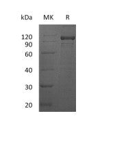 Recombinant Human IL-12RB1 (C-Fc)