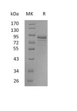 Recombinant Human CHGC (C-6His)