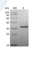 Recombinant Human IgG2 Fc (223AA)