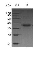 Recombinant Human FOLR1 (C-6His)