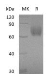 Recombinant Human B7-H3 (C-6His)