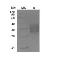 Recombinant Mouse TGFBR2 (C-6His)