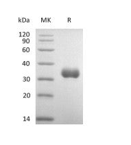 Recombinant Human IGFBP-7 (C-6His)