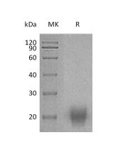 Recombinant Human FSH (C-Flag,C-6His)
