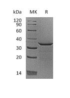 Recombinant Human PDYN (C-6His)