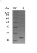 Recombinant Human IL-21