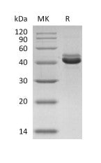 Recombinant Human CD5L (C-6His)