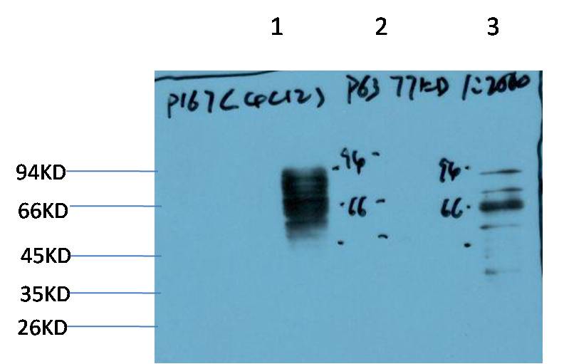 P63-Alpha Mouse Monoclonal Antibody (4C12)