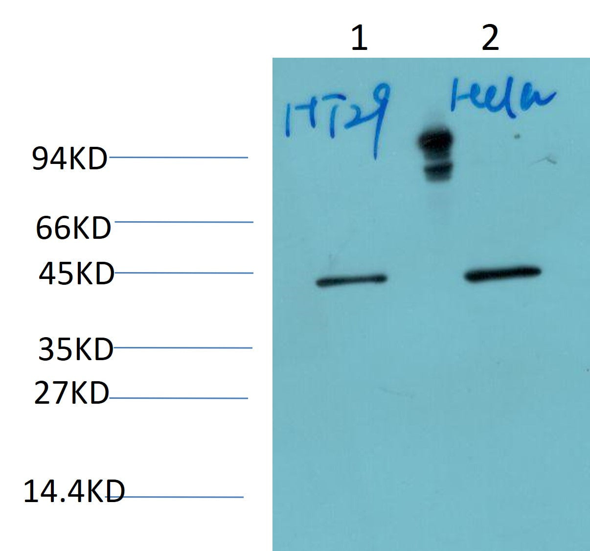 Maspin Mouse Monoclonal Antibody (1D7)