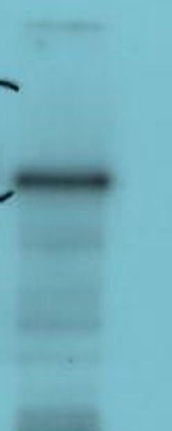 Luciferase Rabbit Polyclonal Antibody