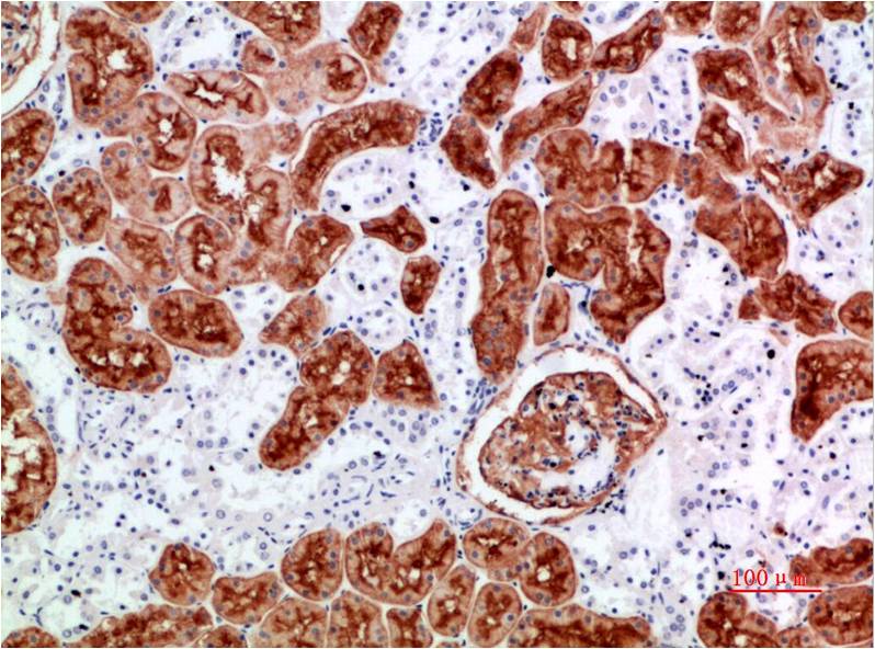 CD10 Rabbit Polyclonal Antibody (CD10)