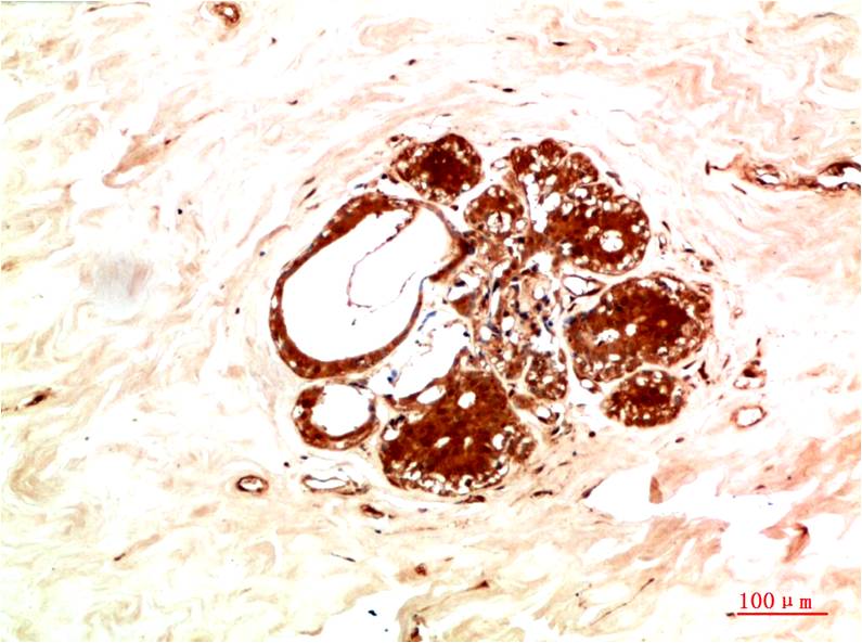 JAK2 Rabbit Polyclonal Antibody (F175)