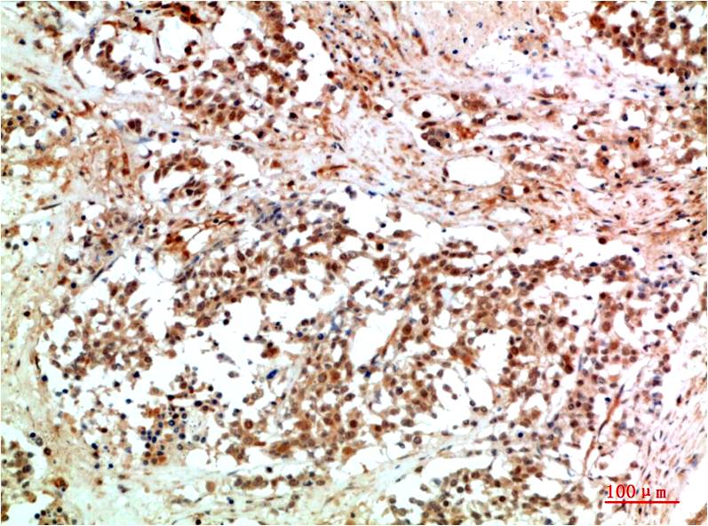 JAK2 Rabbit Polyclonal Antibody (F175)