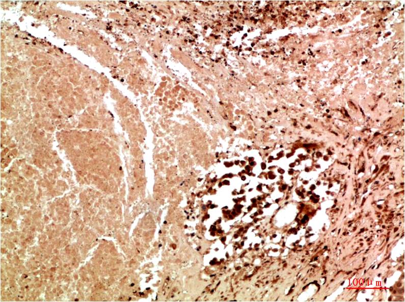 JNK3 Rabbit Polyclonal Antibody (F183)