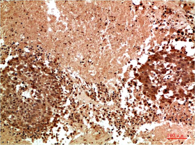 JNK3 Rabbit Polyclonal Antibody (F183)