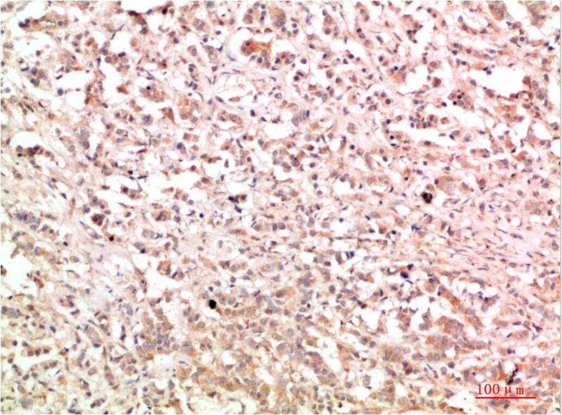 c-Abl Rabbit Polyclonal Antibody (F314)
