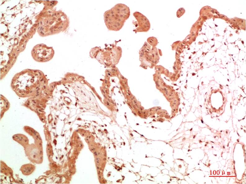 c-Abl Rabbit Polyclonal Antibody (F314)