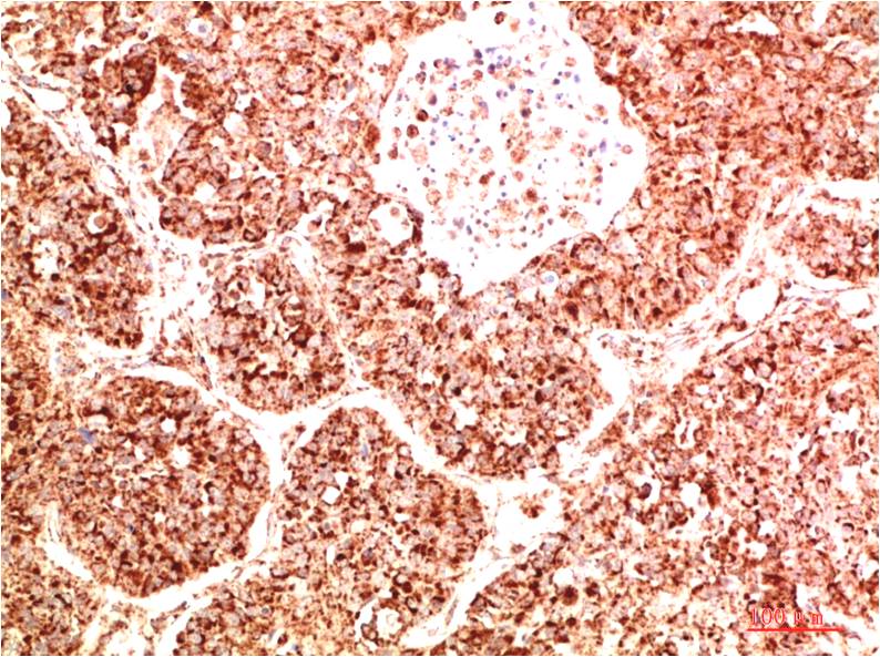 FAK Rabbit Polyclonal Antibody (F345)