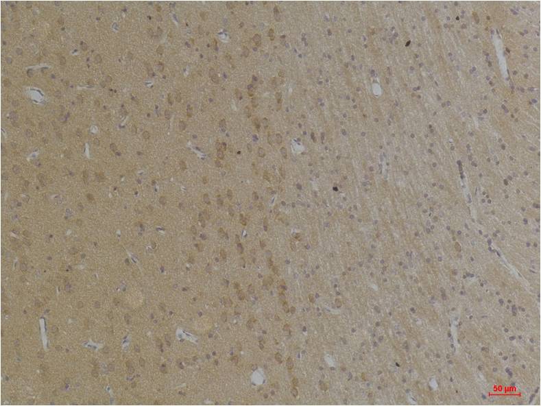 KCNK4 (TRAAK) Rabbit Polyclonal Antibody (A238)