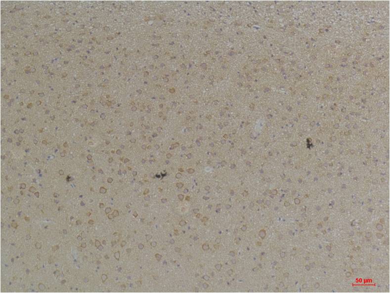 KCNK4 (TRAAK) Rabbit Polyclonal Antibody (A238)