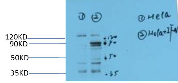 STAT3 (Phospho Y705) Mouse Monoclonal Antibody (1E9)