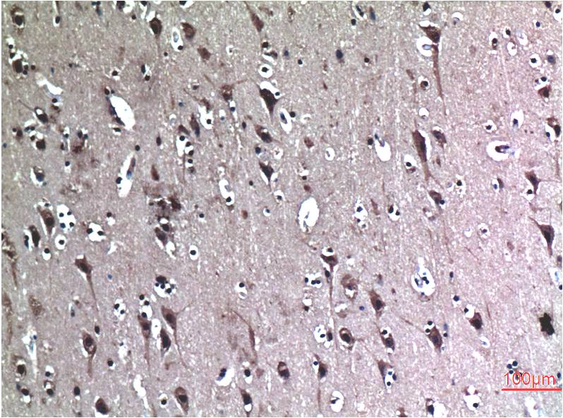 Beclin-1 Mouse Monoclonal Antibody (5C5)