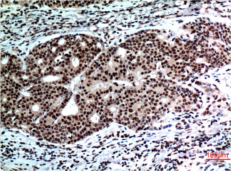 Beclin-1 Mouse Monoclonal Antibody (5C5)