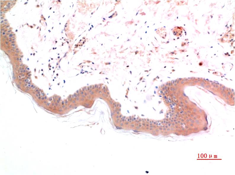 Phospho-Smad3 (S425) Mouse Monoclonal Antibody (1D9)