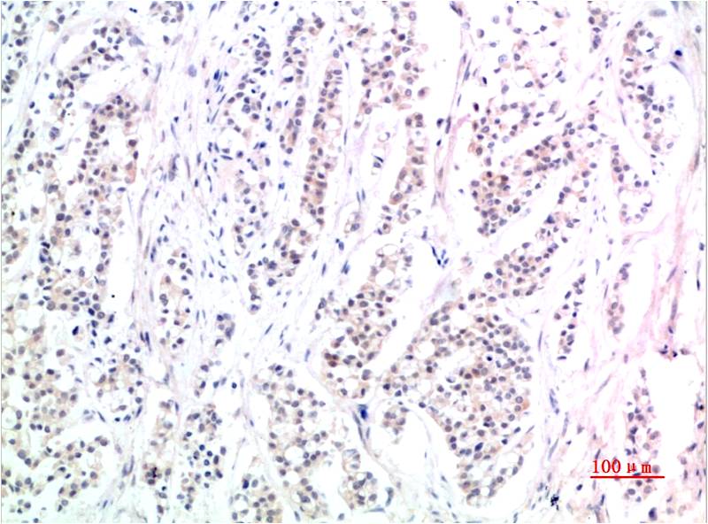 Phospho-Smad3 (S425) Mouse Monoclonal Antibody (1D9)