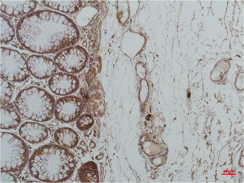 GRP78 Bip Mouse Monoclonal Antibody (10C9)