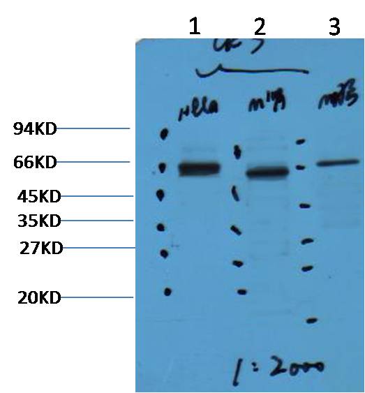 CK7 Mouse Monoclonal Antibody (12D7)