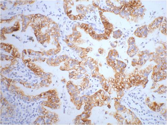 CK7 Mouse Monoclonal Antibody (12D7)