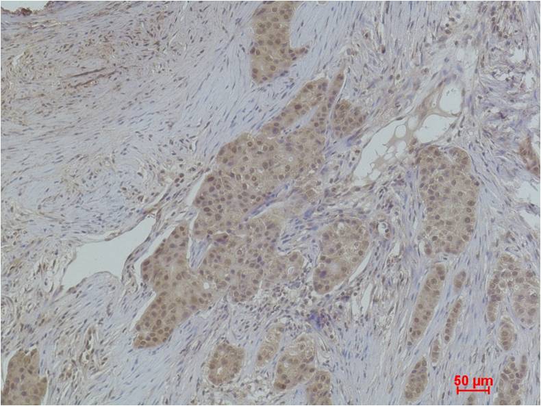 Histone H2A.X (Acetyl Lys5) Rabbit Polyclonal Antibody