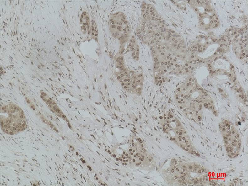 Histone H1 (Tri Methyl Lys25) Rabbit Polyclonal Antibody