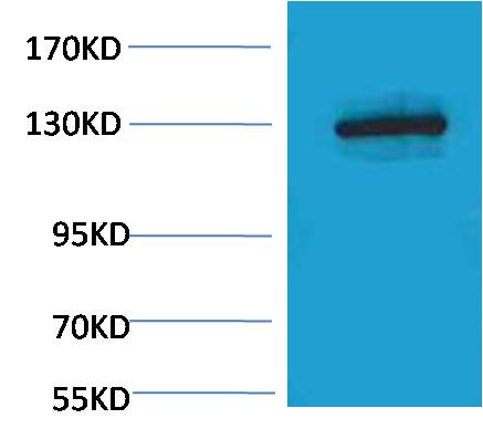 E-Cadherin Rabbit Polyclonal Antibody