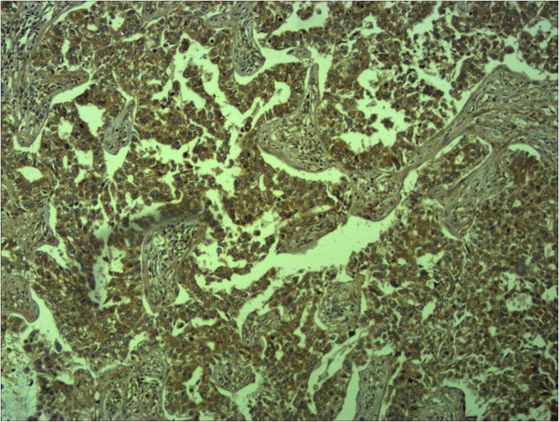 E-Cadherin Rabbit Polyclonal Antibody
