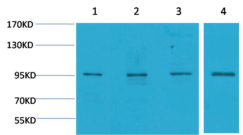 ERK3 Rabbit Polyclonal Antibody (F138)