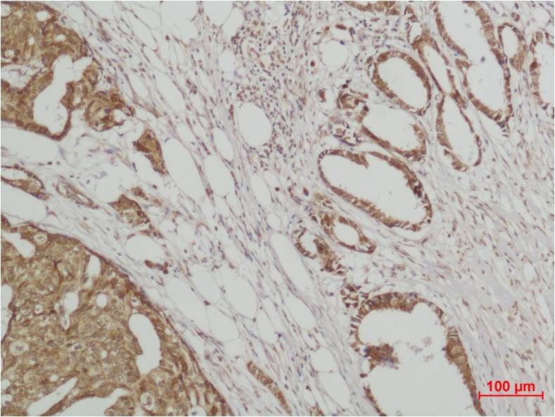 ERK3 Rabbit Polyclonal Antibody (F138)