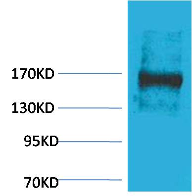 EPG5 Rabbit Polyclonal Antibody (121-240)