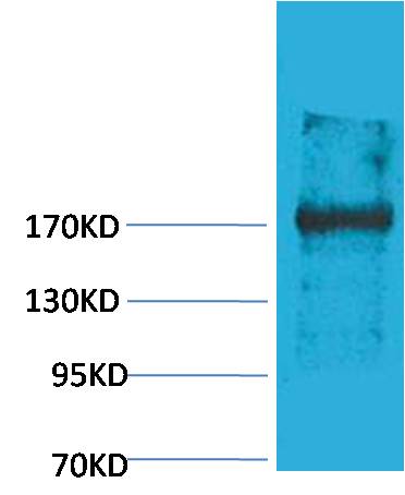EPG5 Rabbit Polyclonal Antibody (241-331)