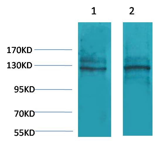 Calcium Sensing Receptor Rabbit Polyclonal Antibody (A192)