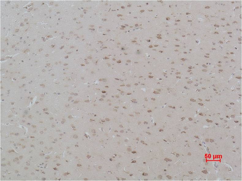 Calcium Sensing Receptor Rabbit Polyclonal Antibody (A192)